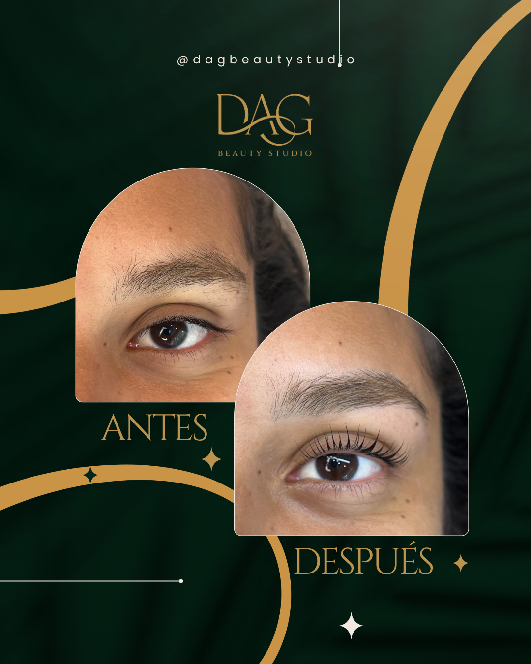 Antes y después